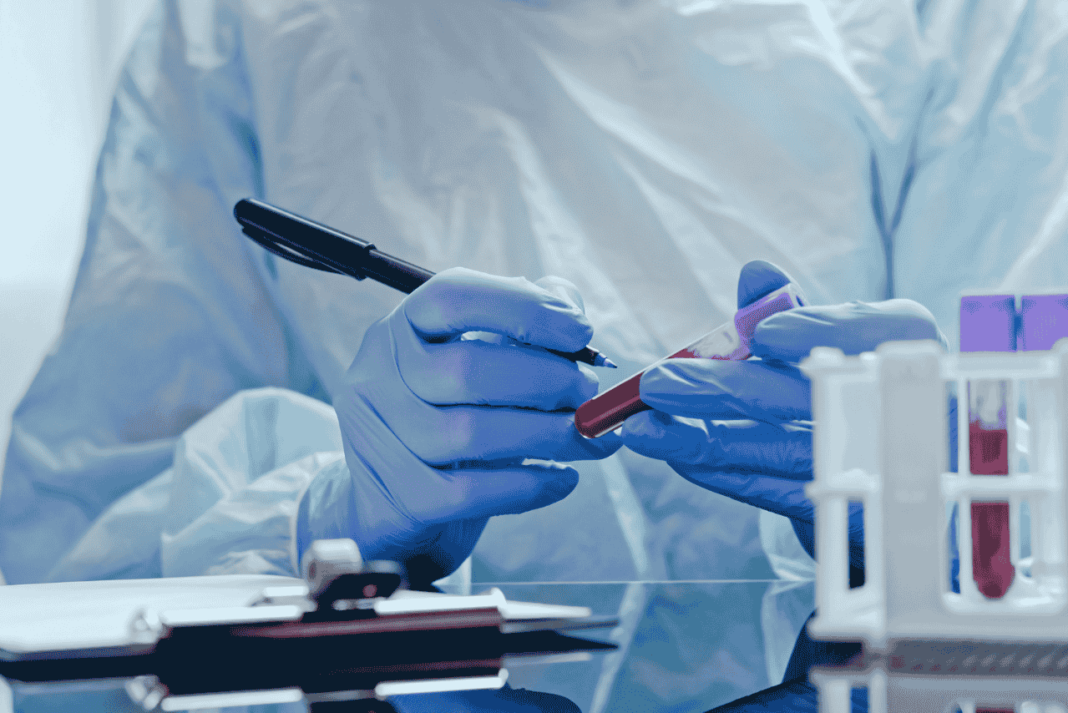 Japanese scientists develop AI blood test for determining biological age Feature Pakistann