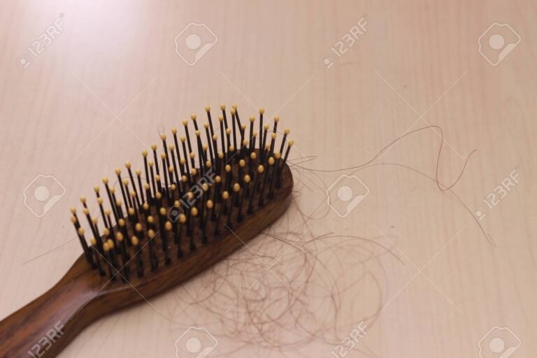 Hair Fall and Zinc Deficiency – What You Must Know Hair Fall and Zinc Deficiency – What You Must Know