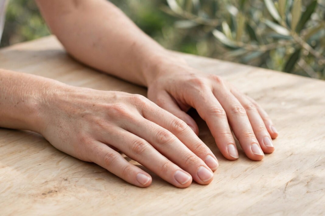 White Spots on Fingernails: What Causes Them White Spots on Fingernails: What Causes Them