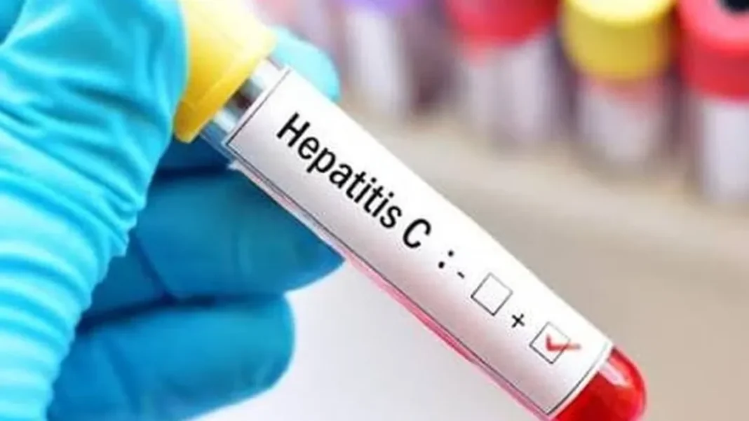 Pakistan Tops World in Hepatitis C Cases, Ministry Tells NA Hepatitis C Pakistan blood test sample held by a gloved hand