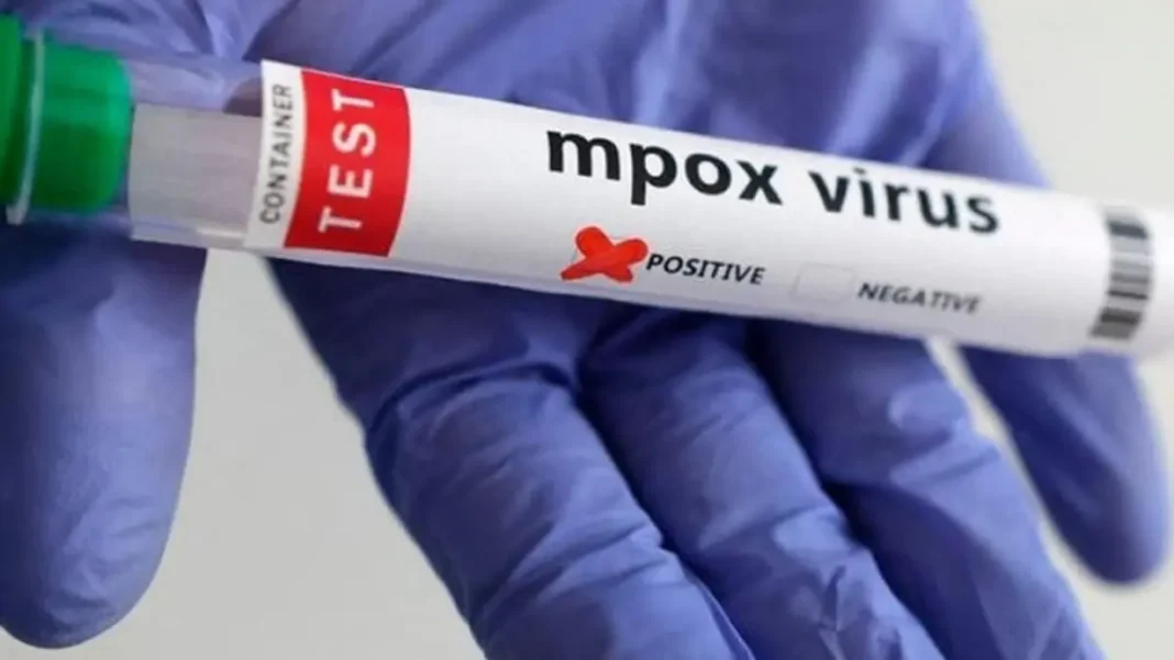 Khyber-Pakhtunkhwa Mpox Cases Rise to 18 Mpox test tube — Khyber-Pakhtunkhwa mpox cases