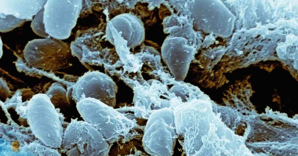 Russian Lab Worker Plague Death: 189 Contacts Under Observation Microscope image of Yersinia pestis bacteria amid the Russian lab worker plague death investigation
