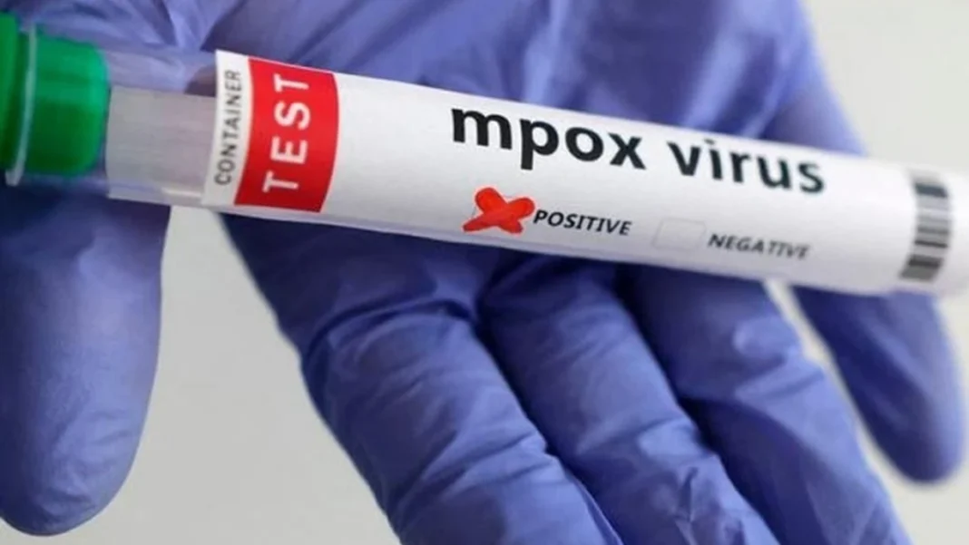 Karachi hospital sealed after mpox detected in newborn circumcision case Karachi hospital mpox newborn