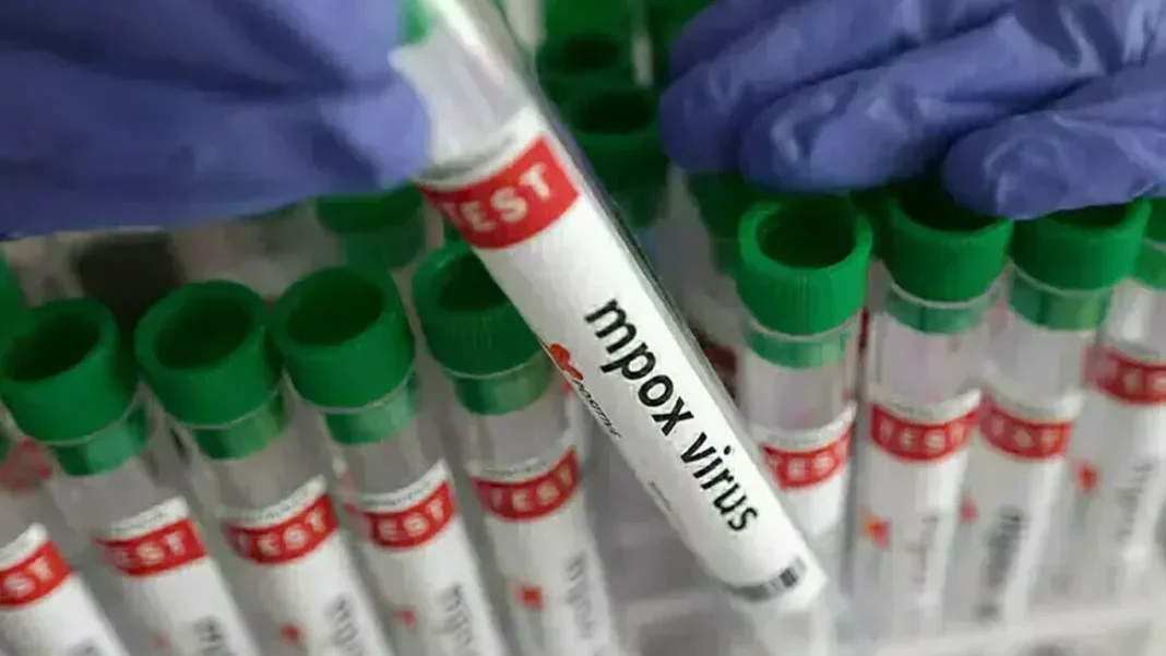 Sindh Mpox Tally 95 Two New Cases