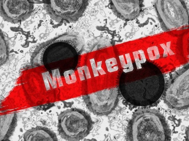Sindh mpox cases reach 93, with 11 deaths reported this year